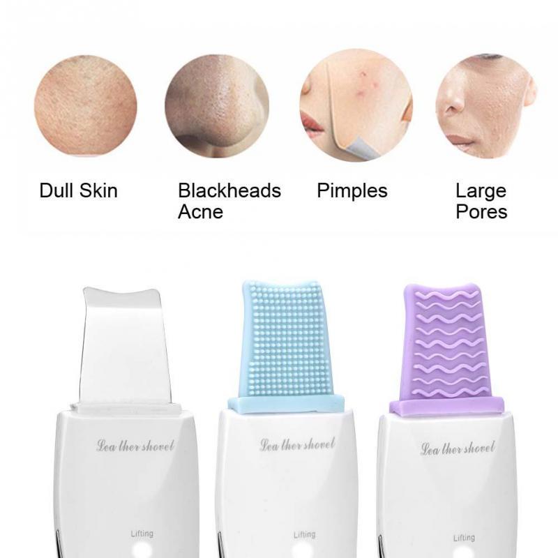 Ultrasonic Leather Shovel Facial Skin Scrubber – Lifting, Moisturizing, Cleansing & Blackhead Remover Tool