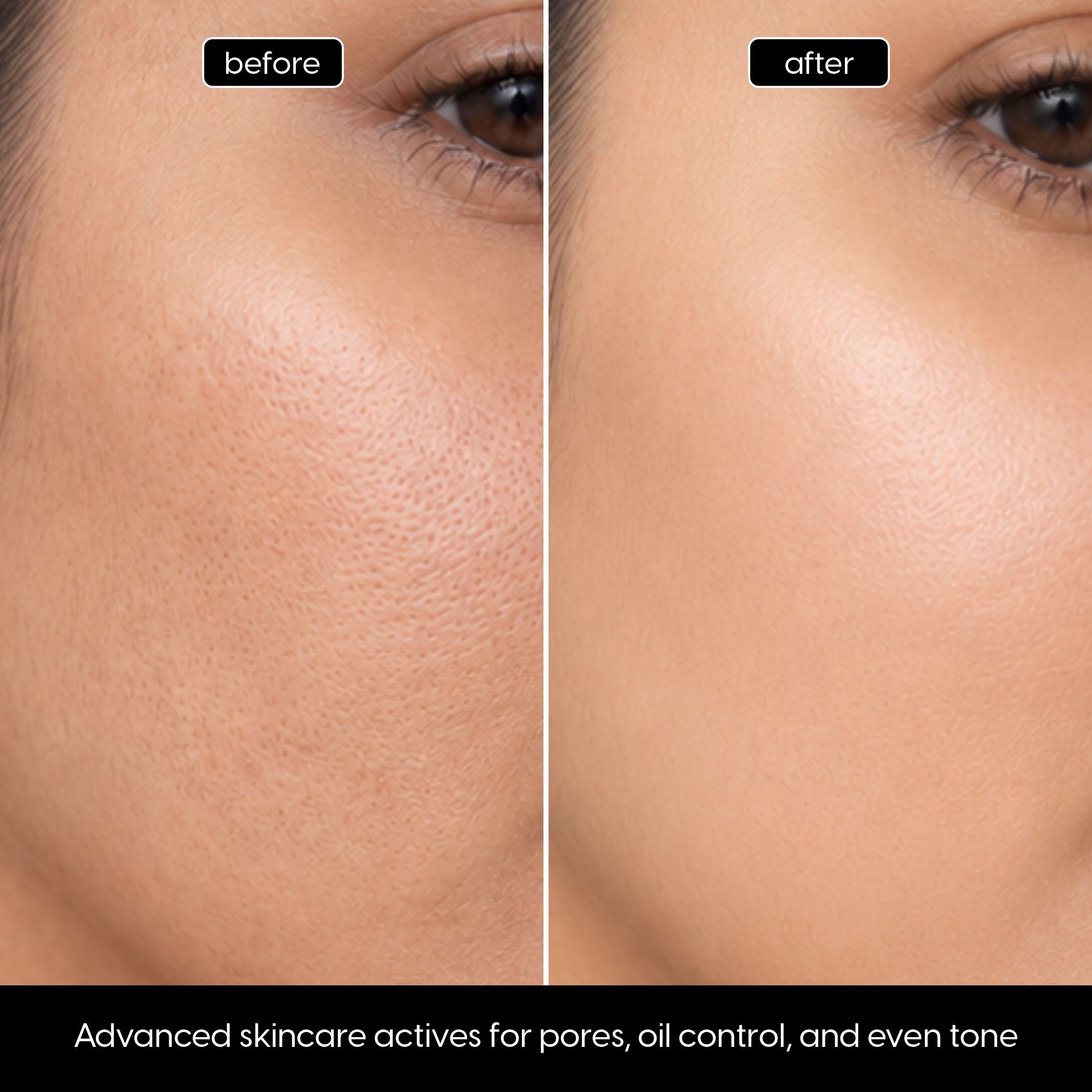 Niacinamide  + Zinc  Serum – Oil Control + Pore Refining for Clear-Looking Skin