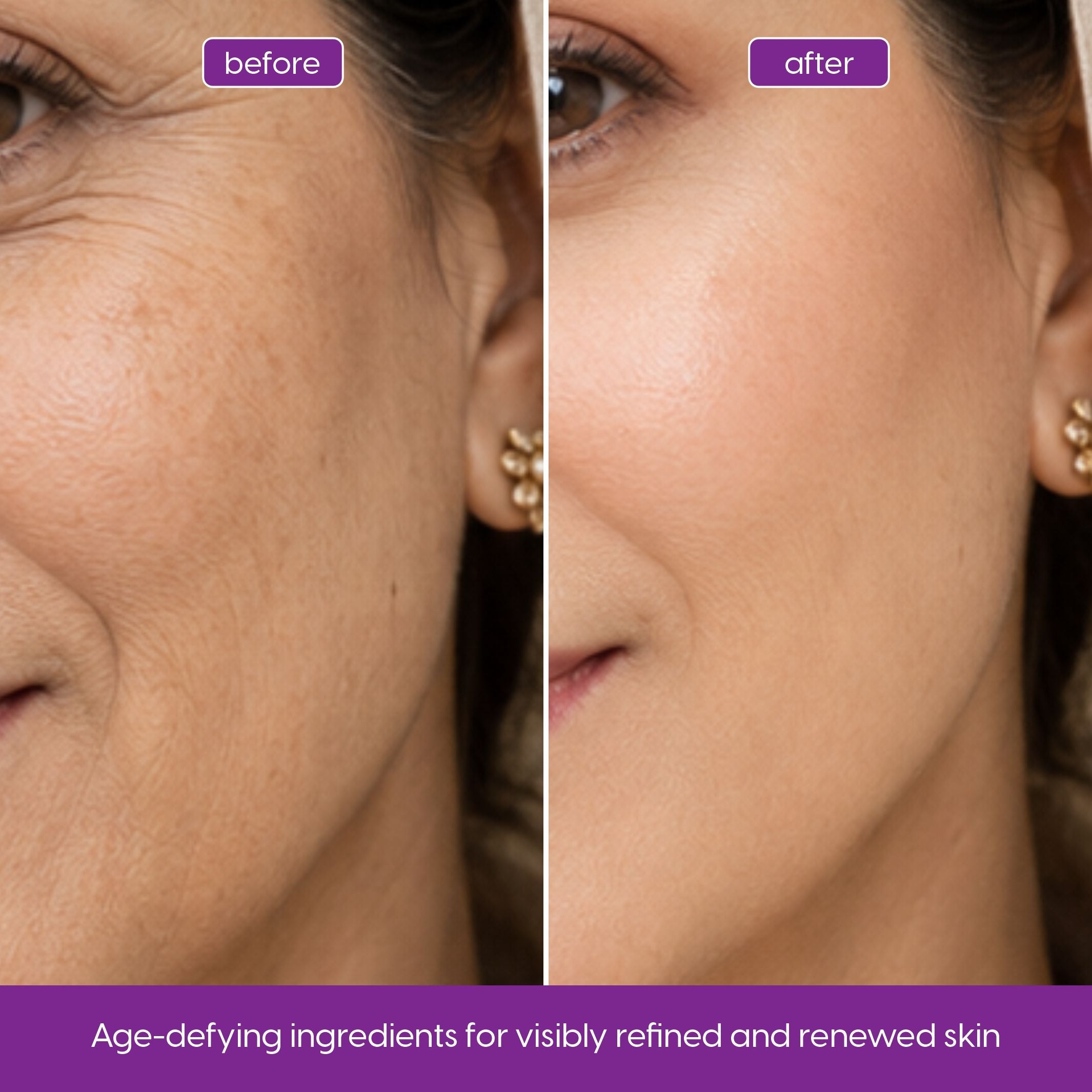 Retinol  Serum – Smoother Texture + Anti-Aging Support with Niacinamide