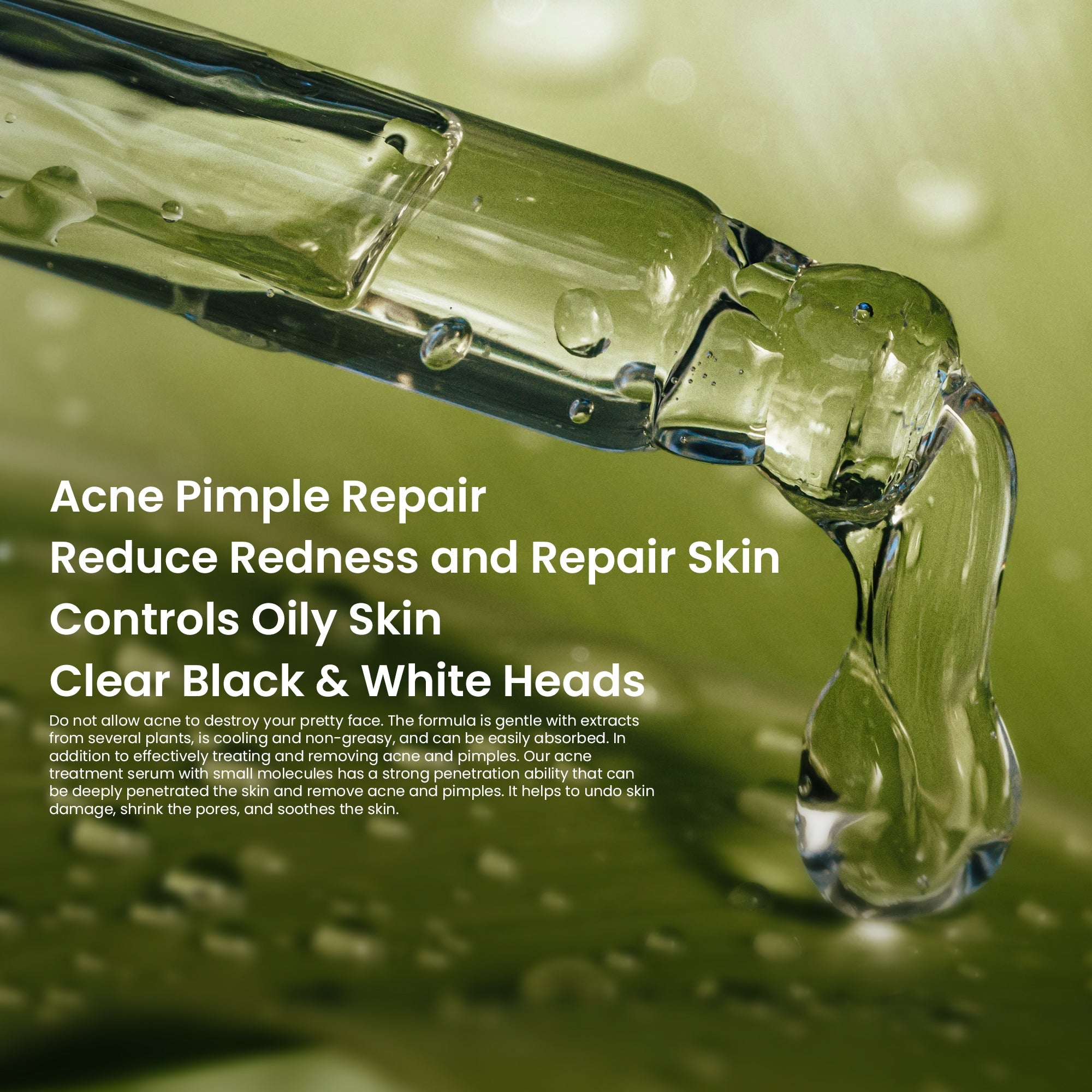 Acne Treatment Face Serum 30ml