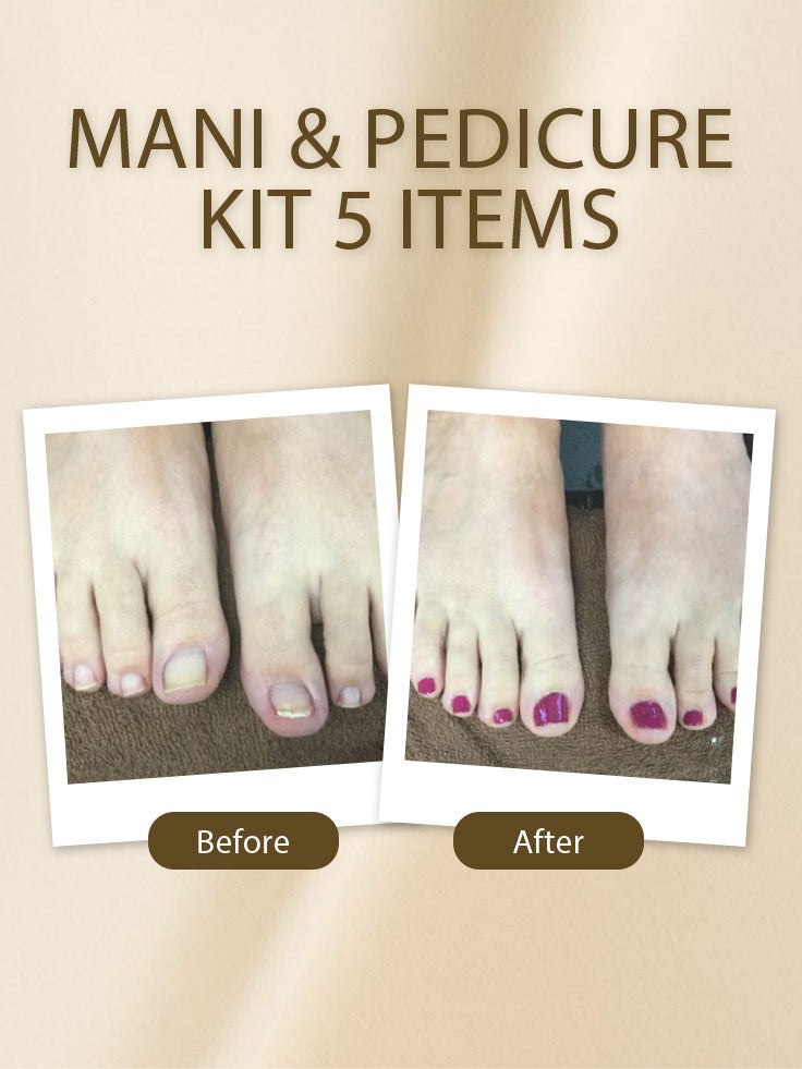 Mani & Pedicure Kit 5 Items