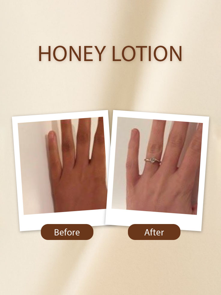 Honey Lotion