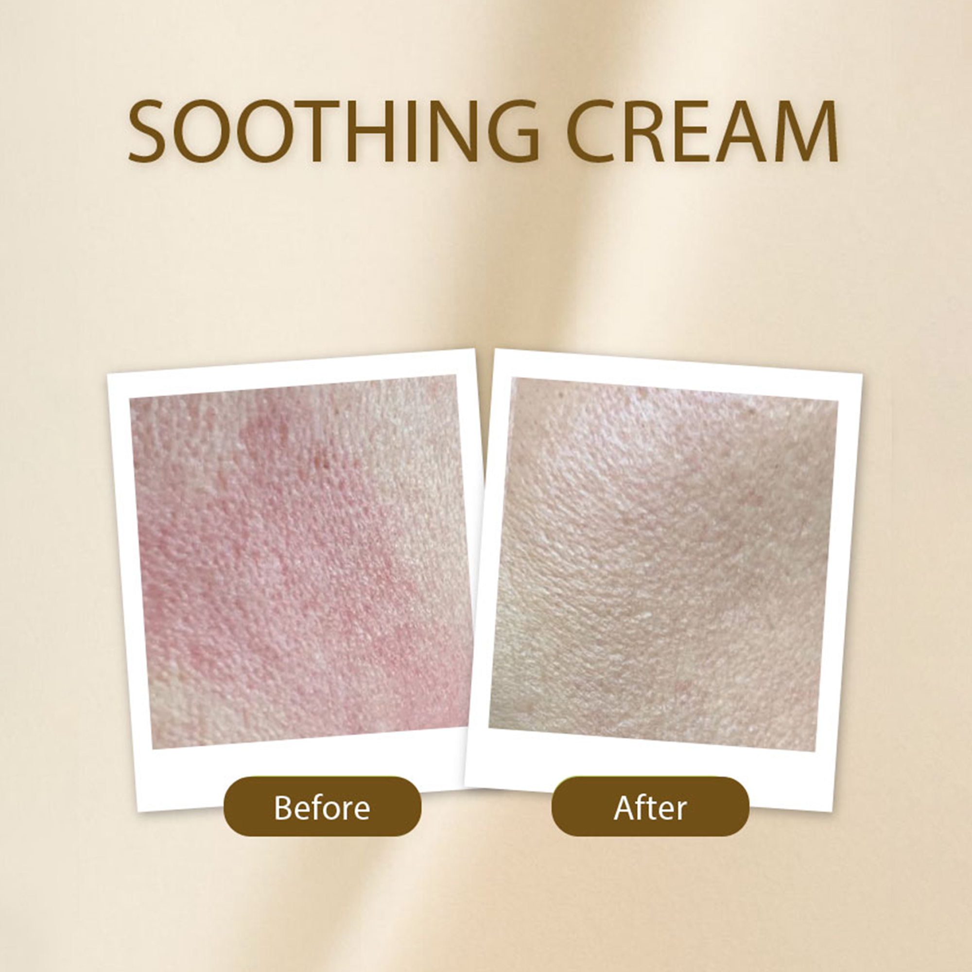 Soothing Cream