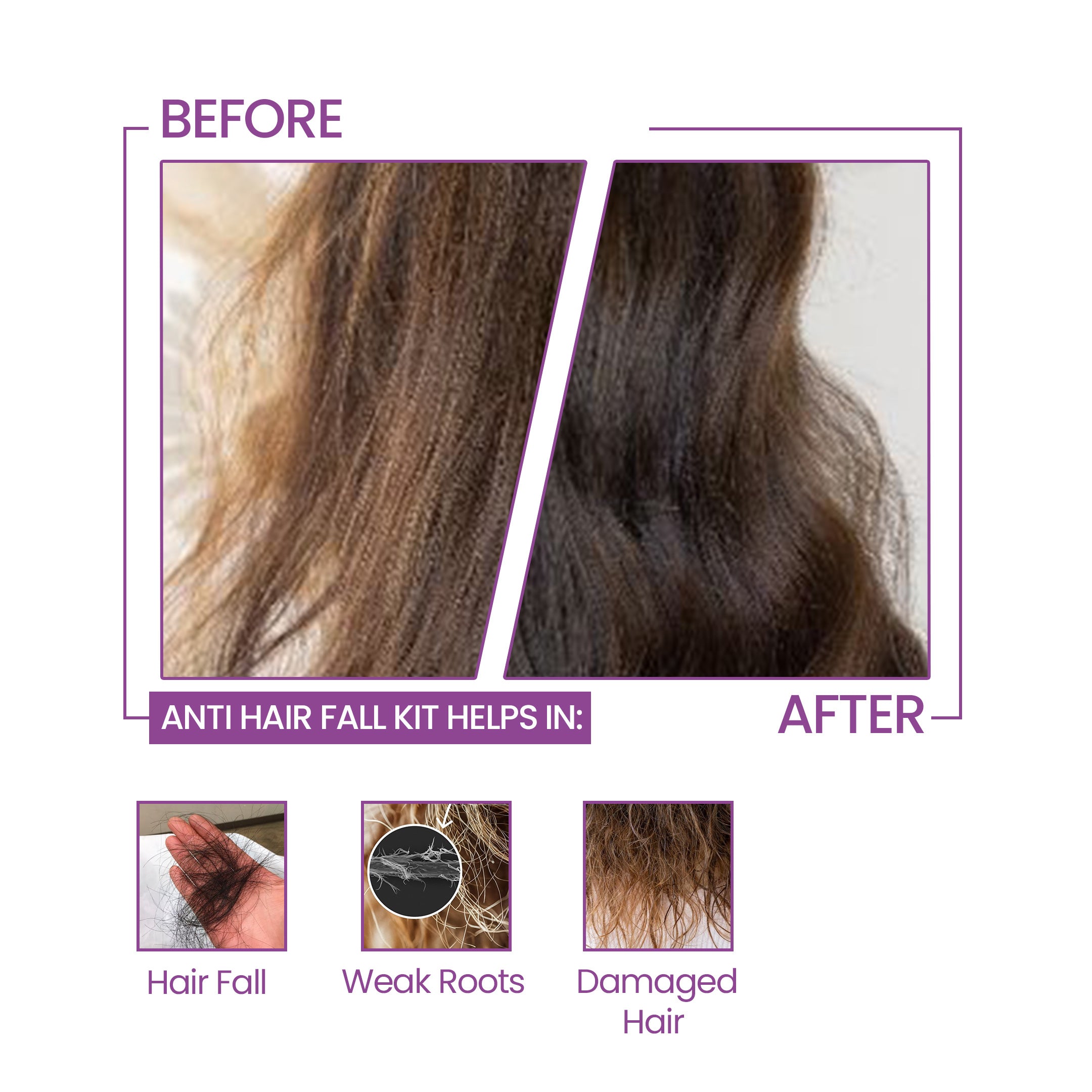 Anti Hair Fall Kit