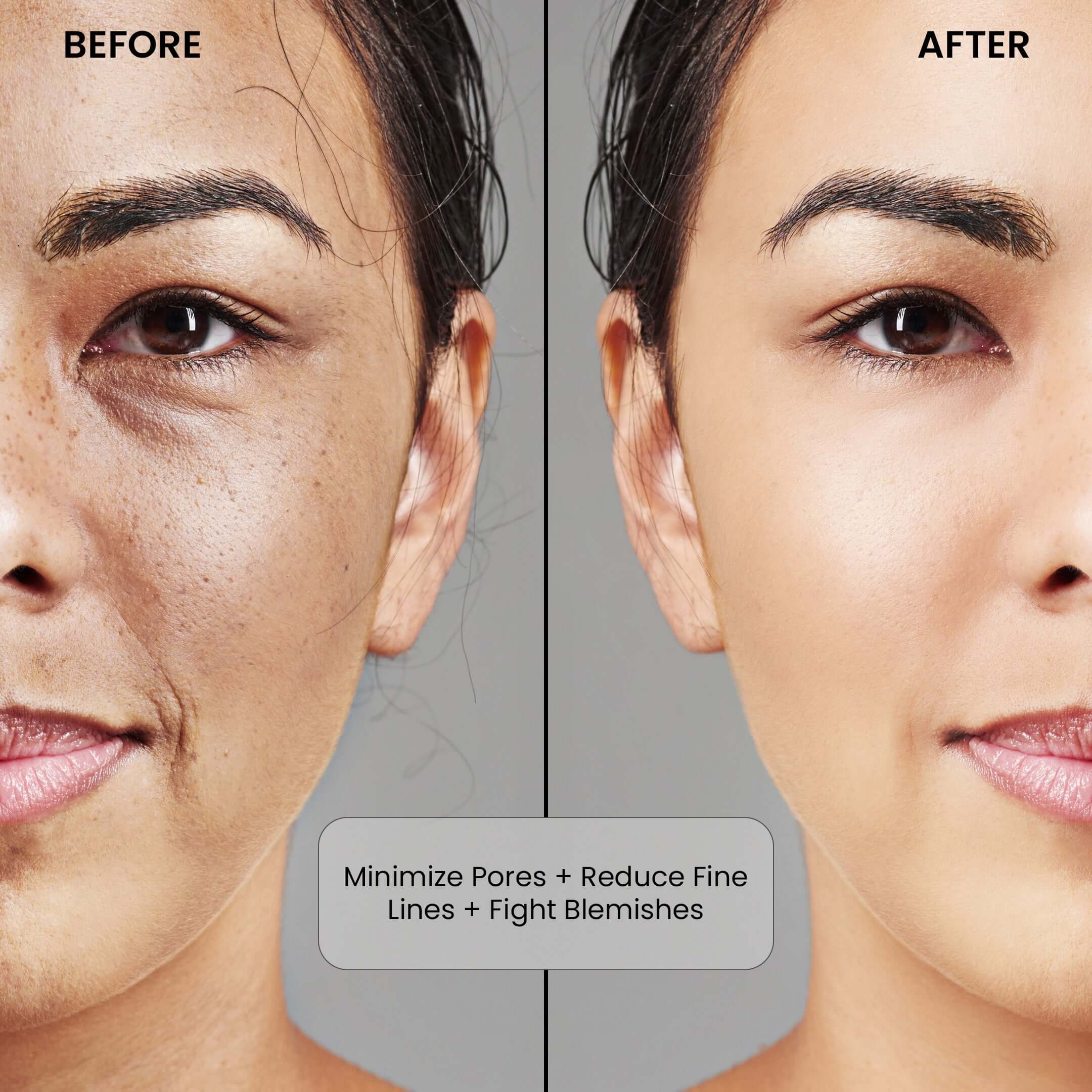 Niacinamide + Zinc Serum