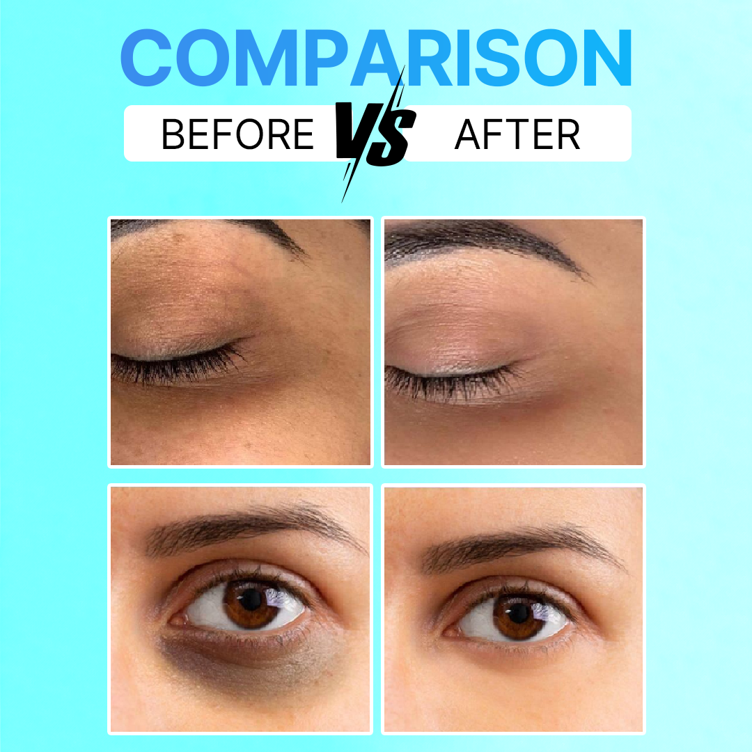Eye Recovery Serum