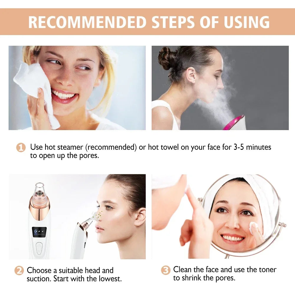 BLACK HEADS ACNE OIL REMOVER 5 in 1