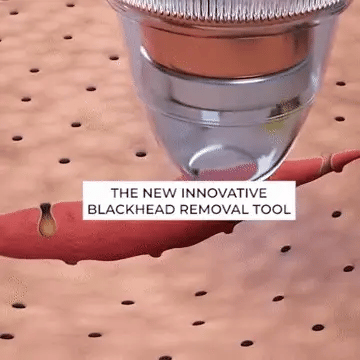 BLACK HEADS REMOVEL MACHINE 6-IN-1
