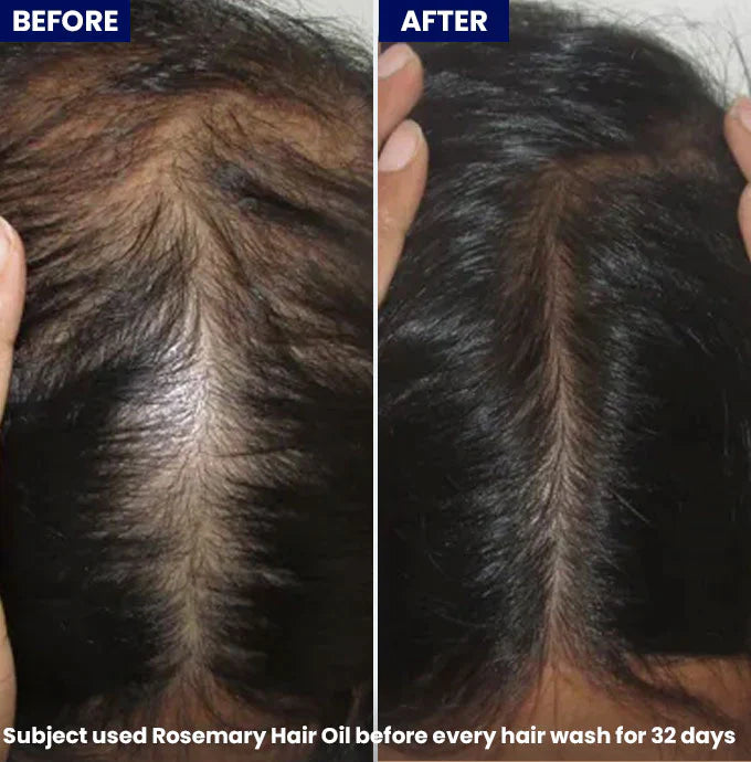 Jenpharm Anagrow Rosemary Hair Oil -  100ml