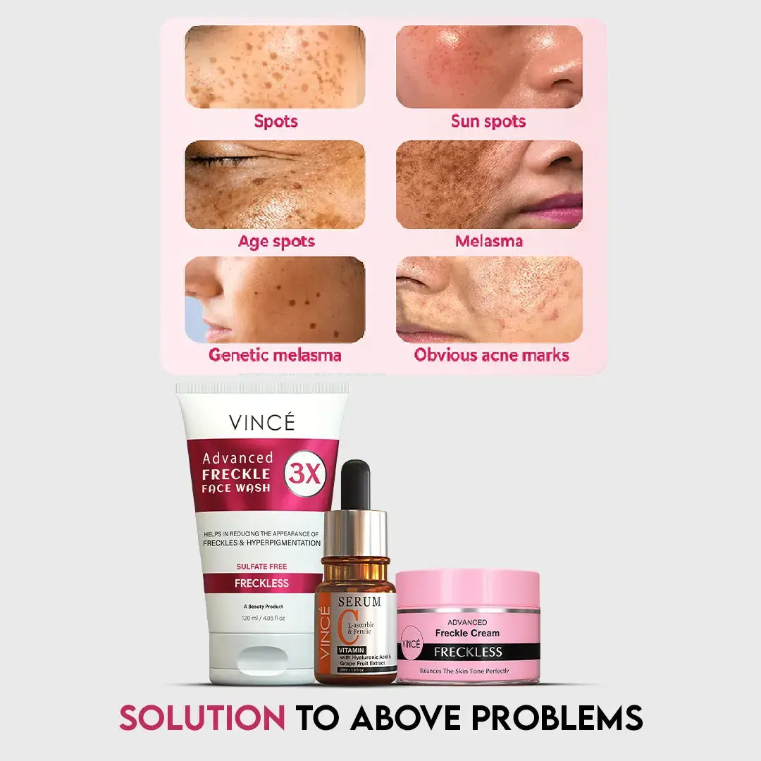 Freckle Challenge Kit